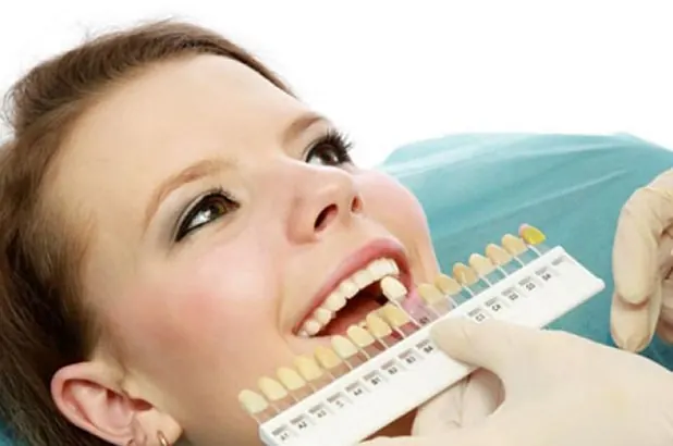 Professional teeth whitening at Overland Park Dental Design