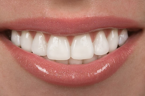 Natural-Cosmetic-Dentistry