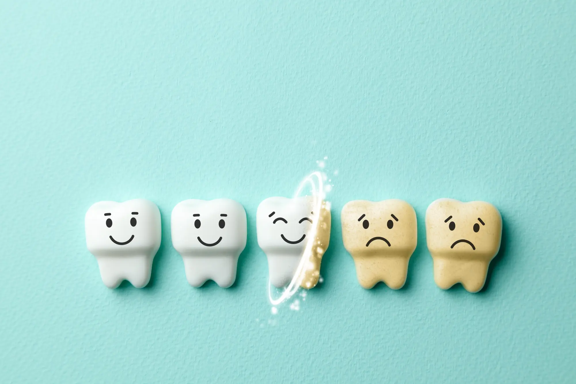 Professional Whitening in overland park